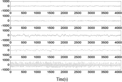 Auto-Weighted Multi-View Discriminative Metric Learning Method With Fisher Discriminative and Global Structure Constraints for Epilepsy EEG Signal Classification